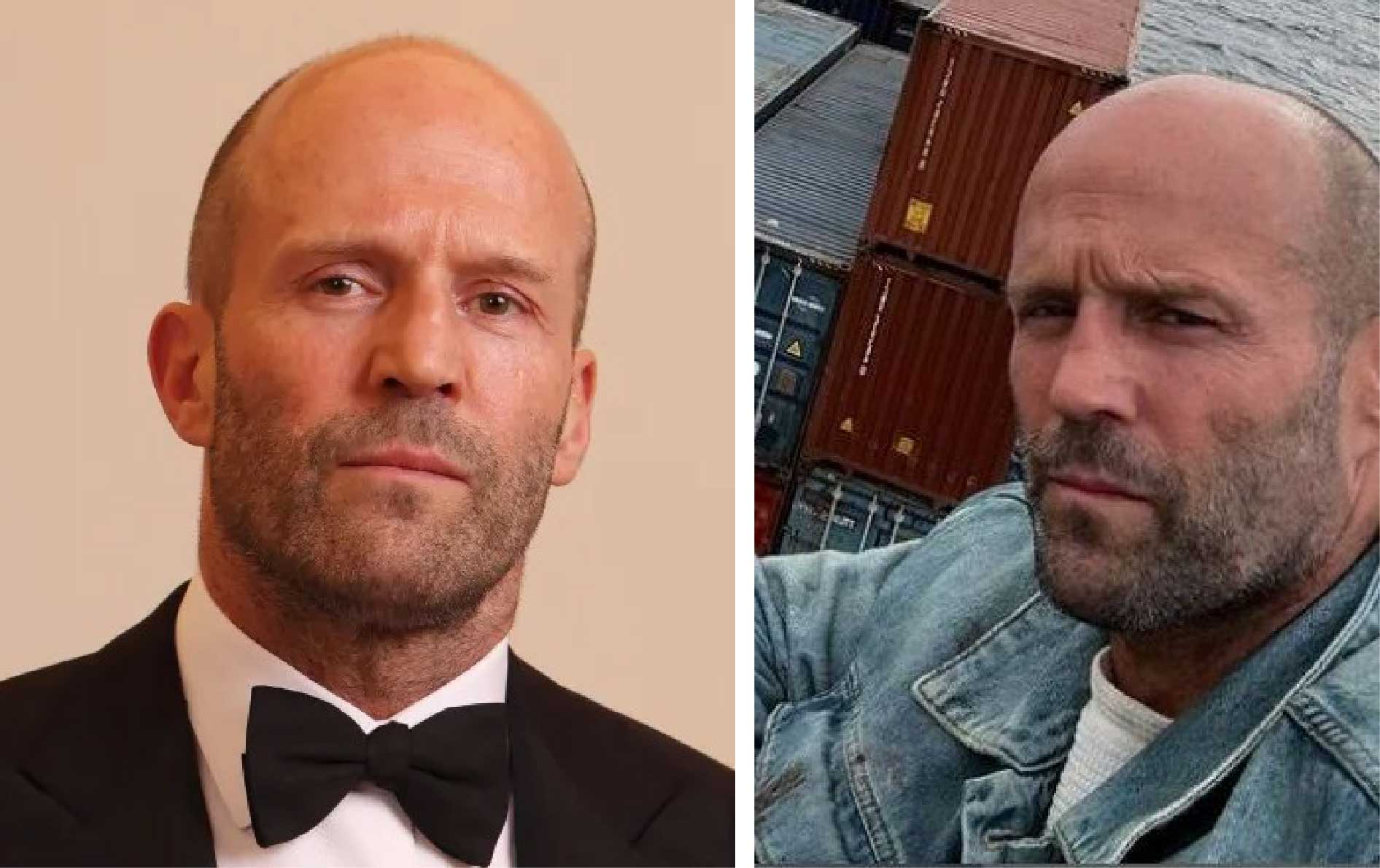 Jason Statham Krankheit